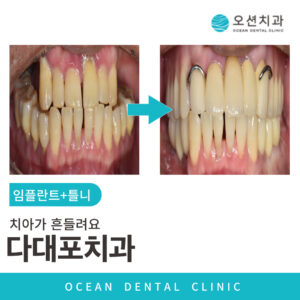 제목을-입력해주세요_-001_(14)