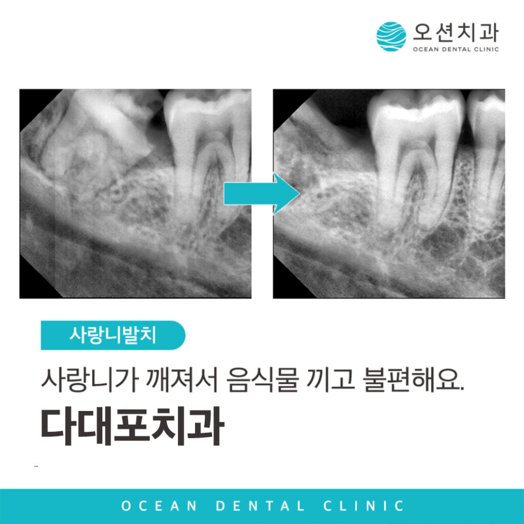 다대포치과 