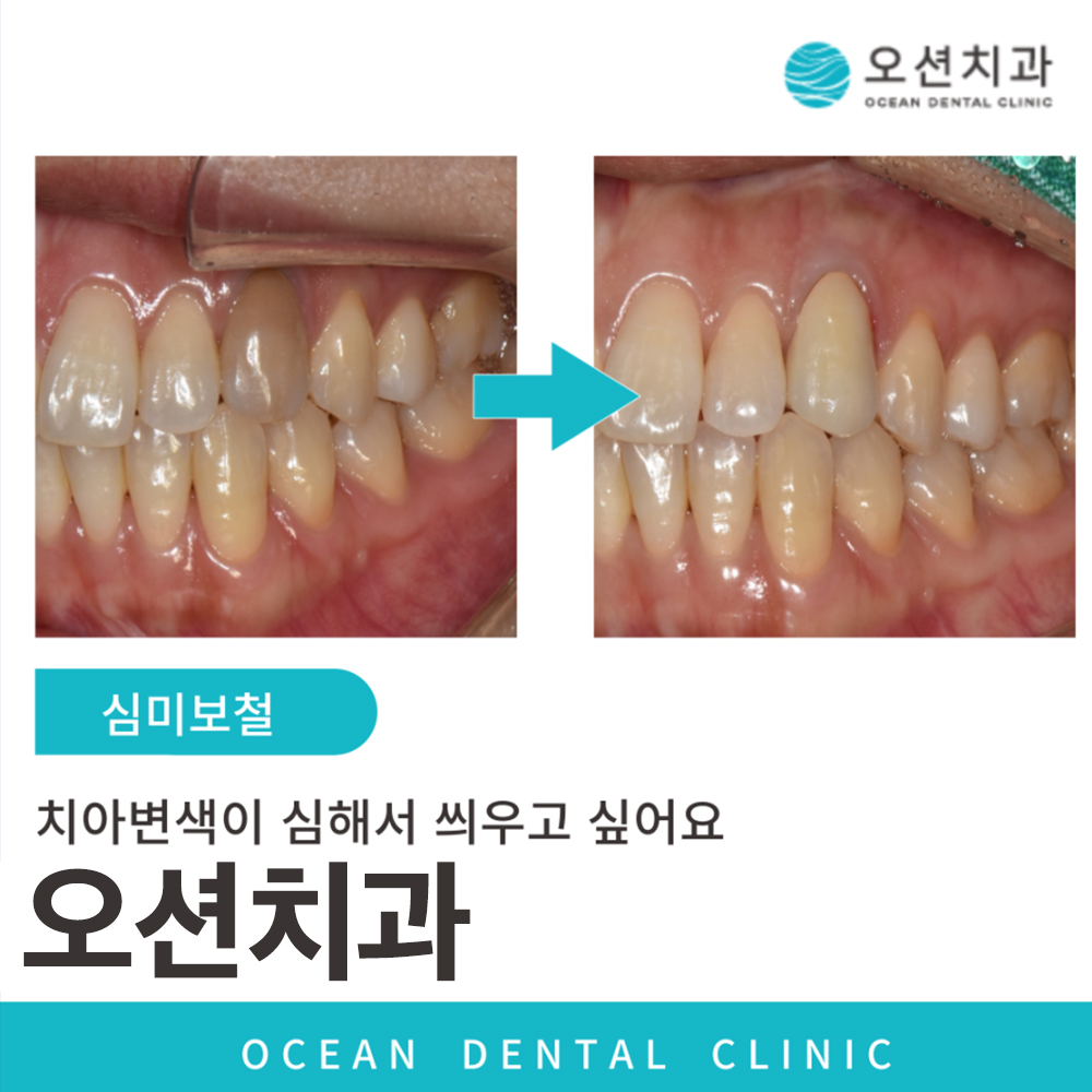 오션치과