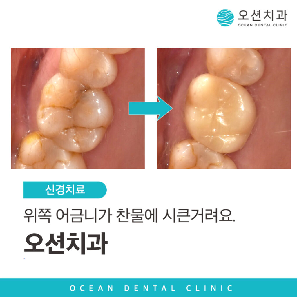 오션치과 