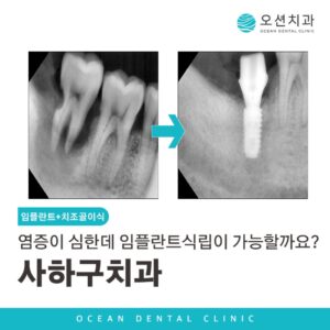 ​사하구치과