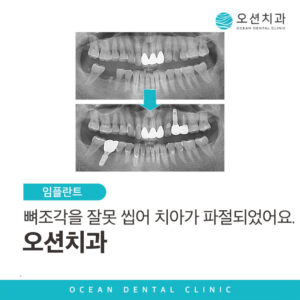 제목 (1)