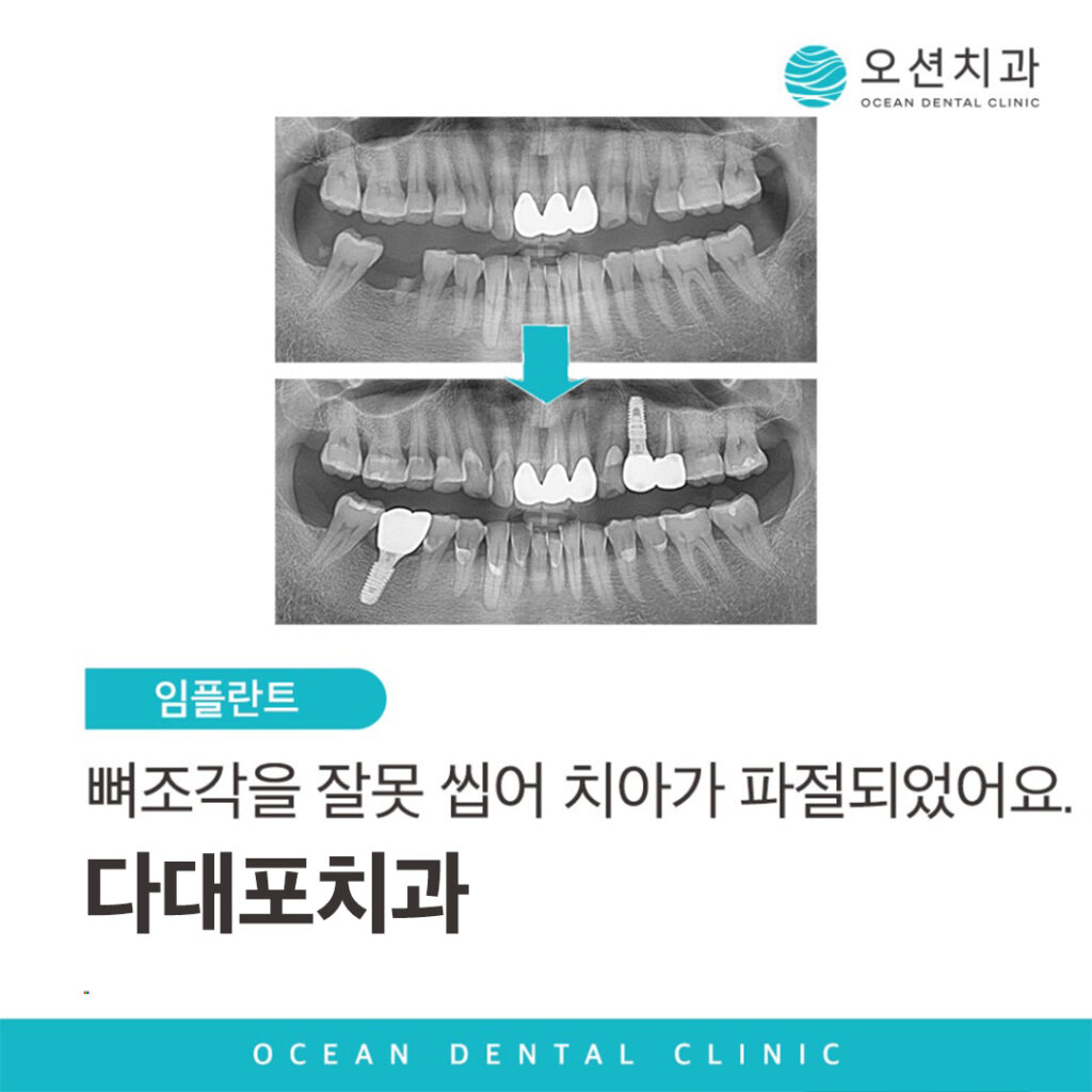 다대포치과
